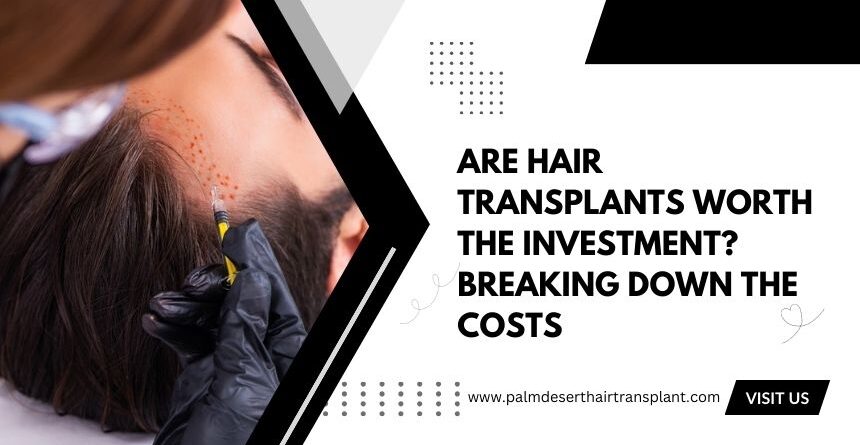 Are Hair Transplants Worth the Investment? Breaking Down the Costs